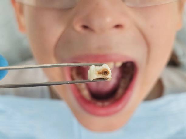 Best Emergency Dental Services for Seniors in Unionville, TN
