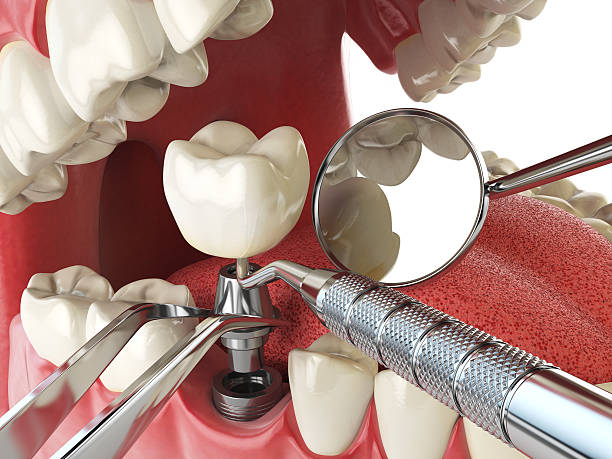 Best Pediatric Emergency Dentist in Unionville, TN