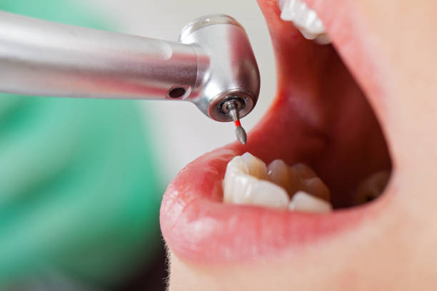 Best Urgent Dental Care for Toothache in Unionville, TN